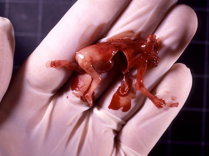 Սարսափելի լուսանկարներ.  հղիության ընդհատում (ֆոտոշարք)