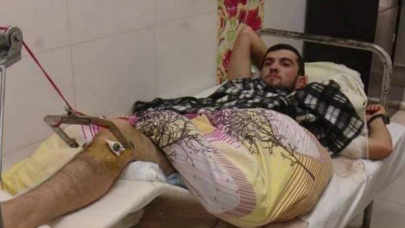 Ադրբեջանցի ռազմագերին արդեն 10 օր է Արցախում հիվանդանոցում է, նա վիրահատվել է. հայտնի է անունը