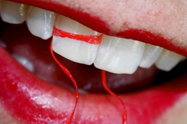 Շրթներկը փչացնում է ատամները