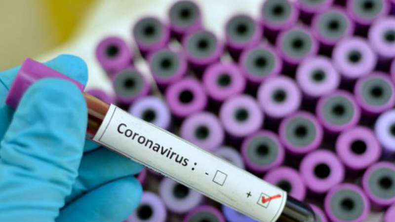 Հայաստանում հաստատվել է կորոնավիրուսային հիվանդության 1013 նոր դեպք
