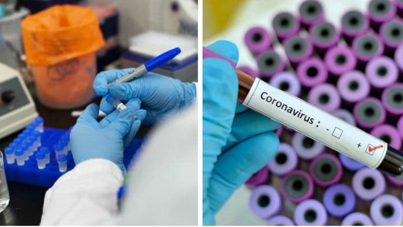 Հայաստանում իրականացվել է 211 լաբորատոր հետազոտություն, որից միայն մեկի դեպքում է կորոնավիրուս հայտնաբերվել