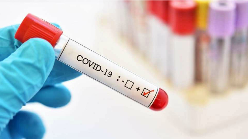 Վրաստանում մեկ օրում գրանցվել է կորոնավիրուսով վարակման 87 նոր դեպք
