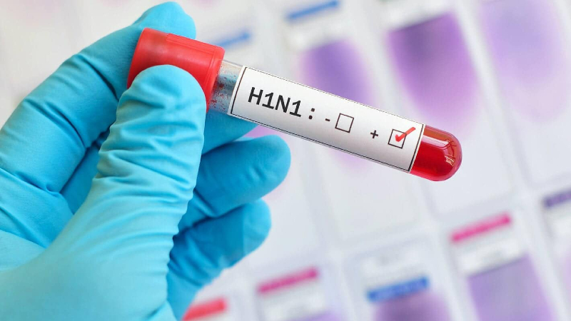 Հայաստանում հաստատվել է գրիպի Ա տեսակի H1N1 ենթատեսակի վիրուսի հարուցիչ
