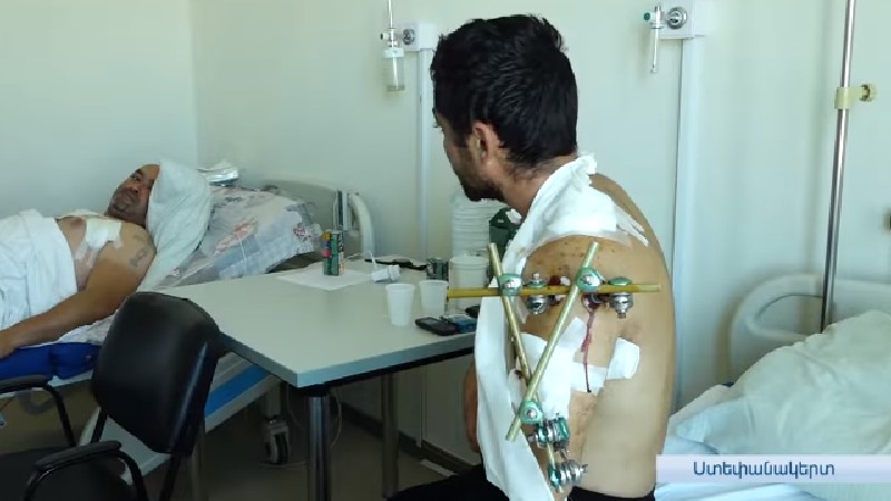 Շուշիի մոտ ադրբեջանական կրակոցներից տուժած քաղաքացիները մանրամասներ են պատմում (տեսանյութ)