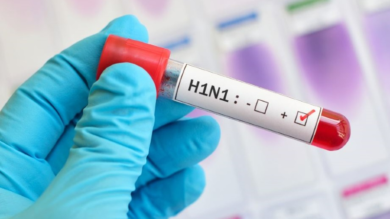 H1N1-ից Հայաստանում մահվան 2 դեպք է գրանցվել