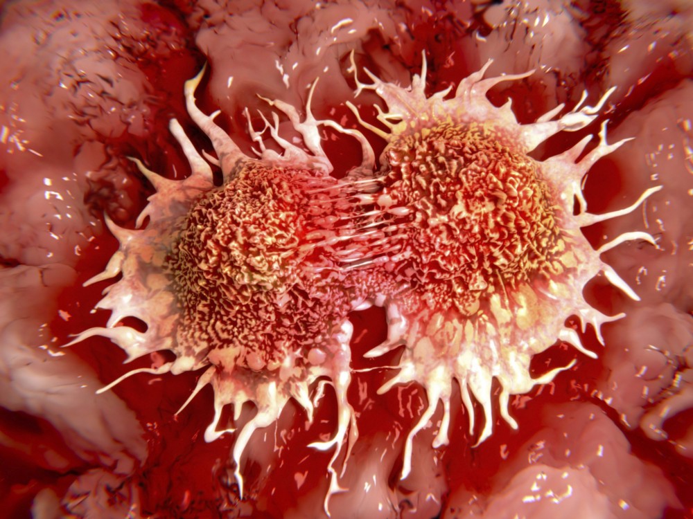 Ученые выяснили, почему раковые клетки не убивают сами себя