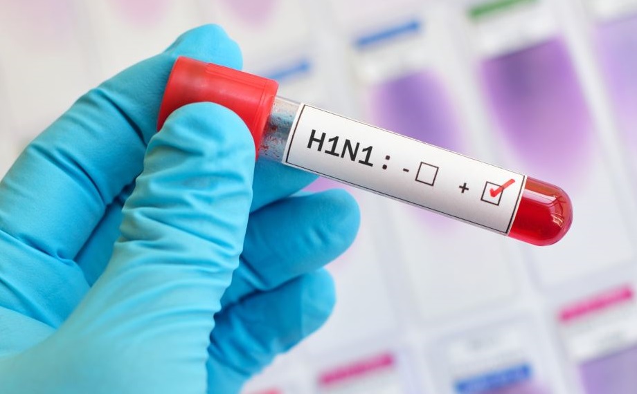 Հայաստանում Ա H1N1 գրիպից մարդ է մահացել