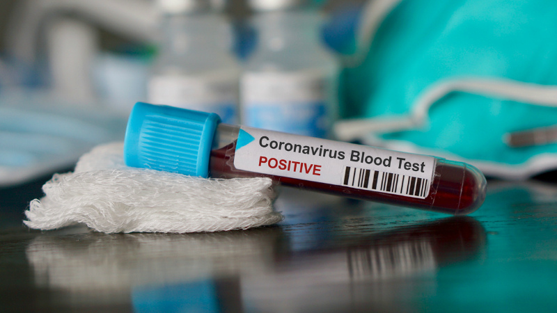 ԵՄ-ն հաստատում է COVID-19 բուժող դեղամիջոց