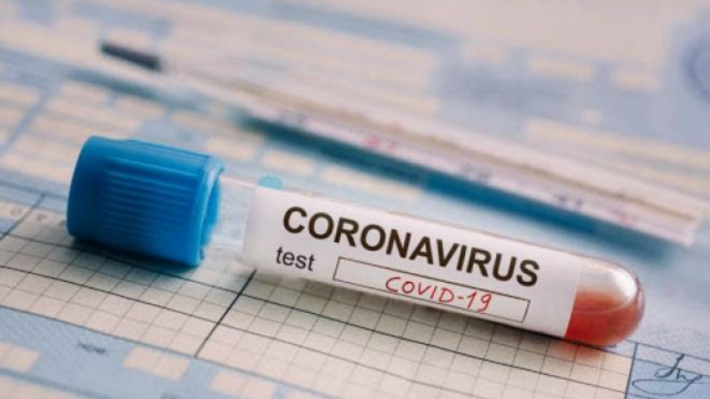 Արցախում կորոնավիրուսային հիվանդության նոր դեպքեր չեն գրանցվել
