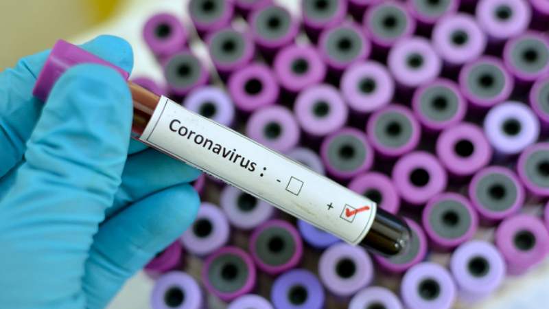 Հայաստանում հաստատվել է կորոնավիրուսի ևս 24 դեպք. գրանցված դեպքերի ընդհանուր թիվը 160 է